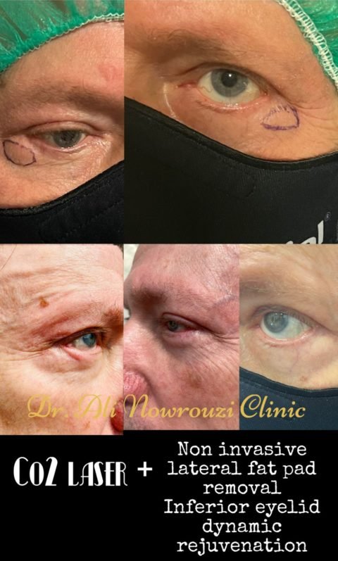Cirugía oculoplástica 7 7