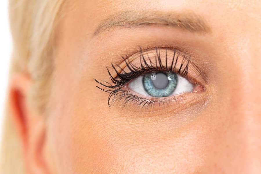 keratoconus-ali-nowrouzi-6