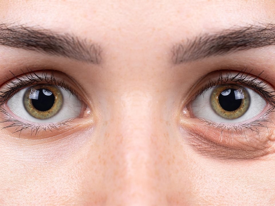 oculoplast ica