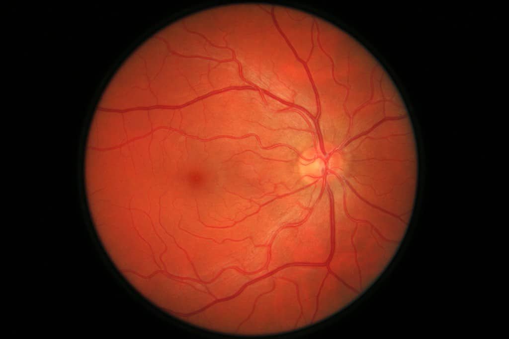 retina foto