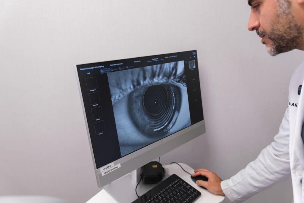 ¿Cuál es la mejor tecnología láser para la cirugía de miopía, hipermetropía, astigmatismo y presbicia? 2 Imagen ampliada del ojo en la pantalla de un equipo de diagnóstico