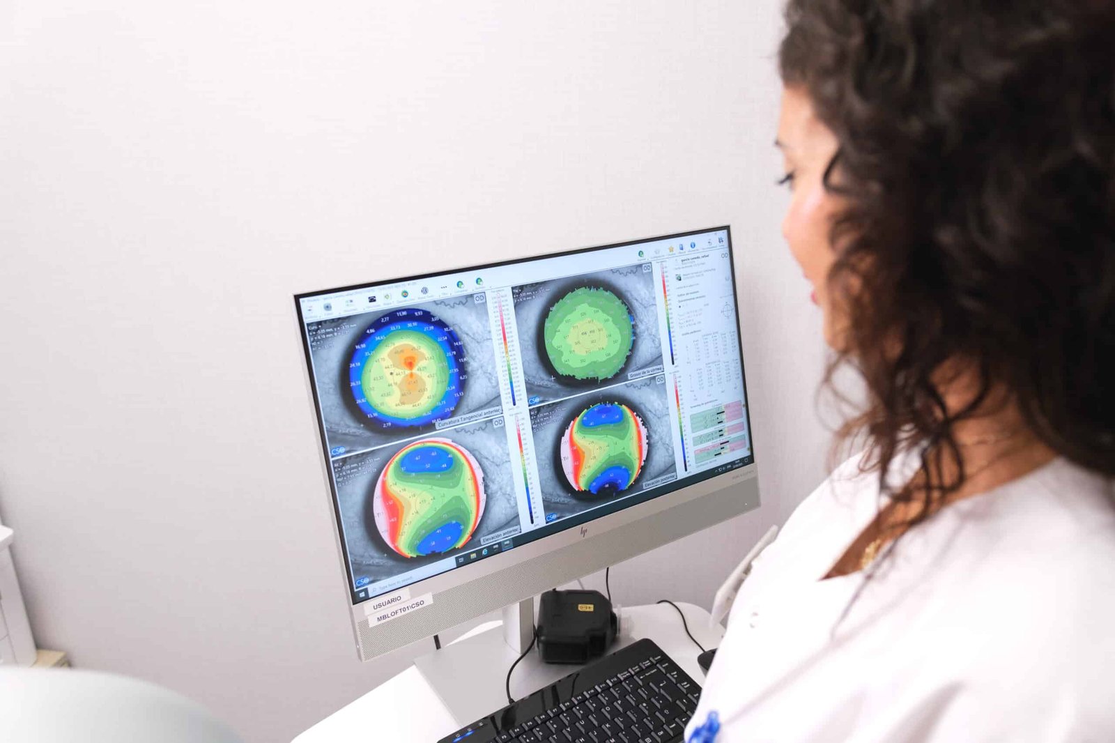 Médico revisando gráficos de topografía corneal en una pantalla de computadora, utilizados para evaluar la salud ocular y personalizar tratamientos.